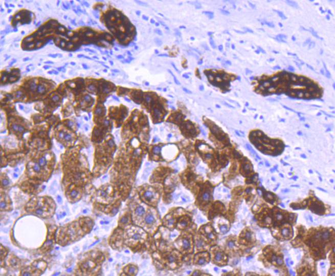 Cytokeratin 8+18 Rabbit mAb