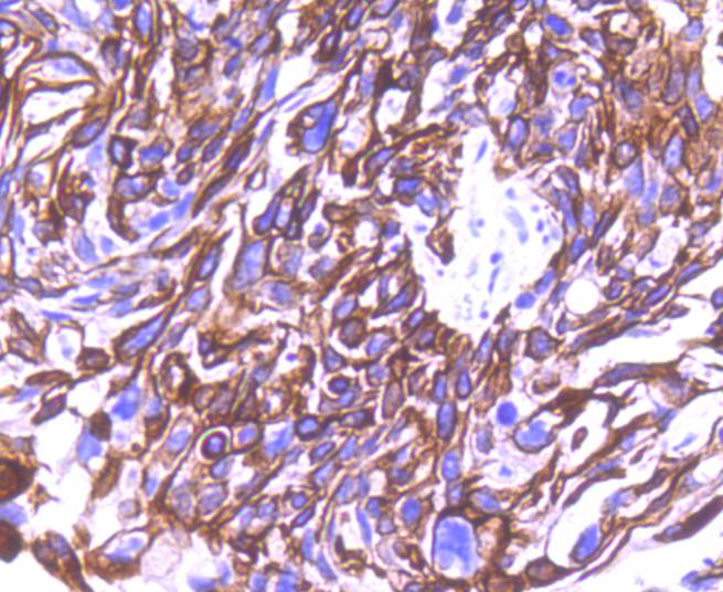 Cytokeratin 8+18 Rabbit mAb