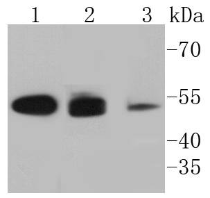 Cytokeratin 8+18 Rabbit mAb