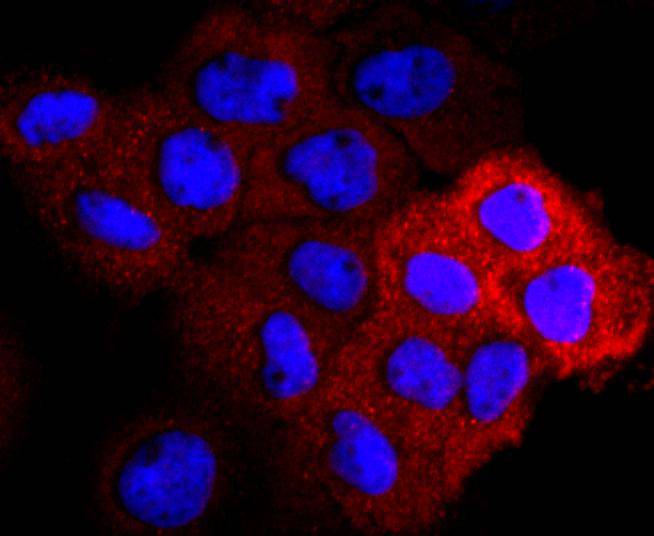 VEGF Receptor 2 Rabbit mAb