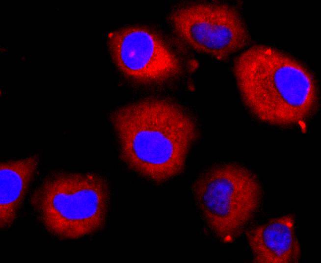 VEGF Receptor 2 Rabbit mAb