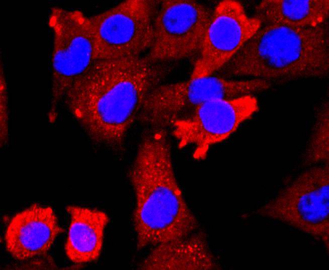 VEGF Receptor 2 Rabbit mAb