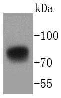 5T4 Rabbit mAb