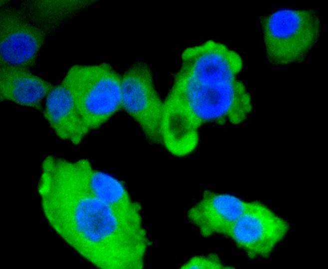 AMPK alpha 1 Rabbit mAb