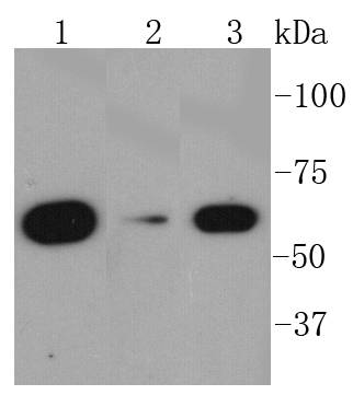 AMPK alpha 1 Rabbit mAb