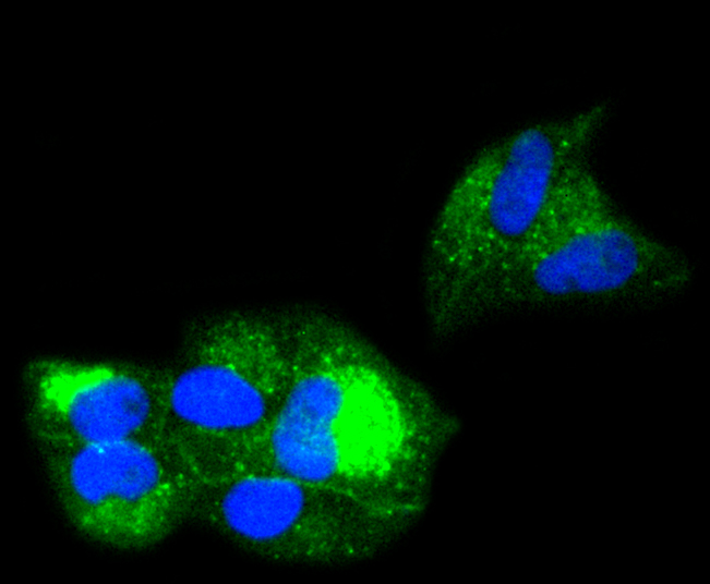 beta 2 Microglobulin Rabbit mAb