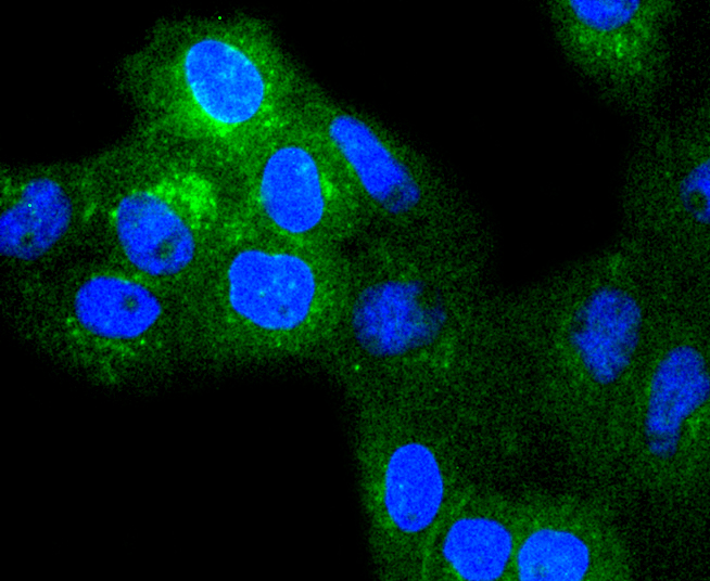 beta 2 Microglobulin Rabbit mAb