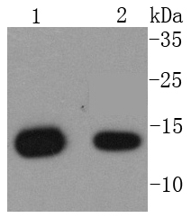 beta 2 Microglobulin Rabbit mAb