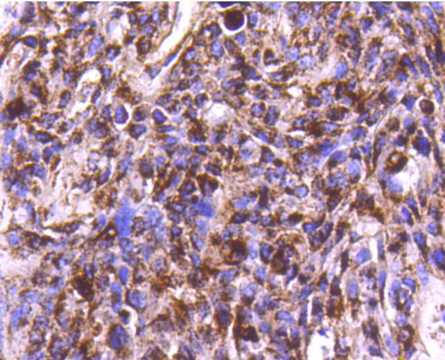 Cathepsin D Rabbit mAb