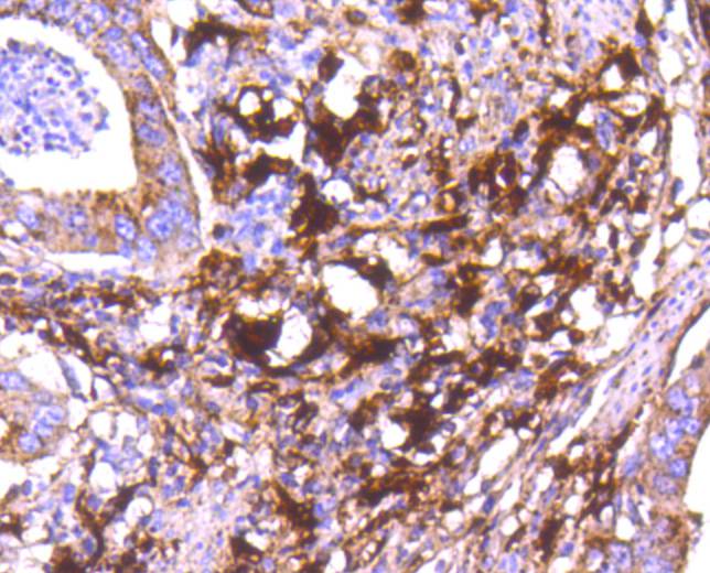 Cathepsin D Rabbit mAb