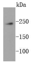 mTOR Rabbit mAb