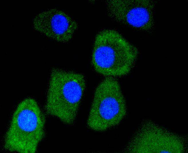 Lactate Dehydrogenase Rabbit mAb