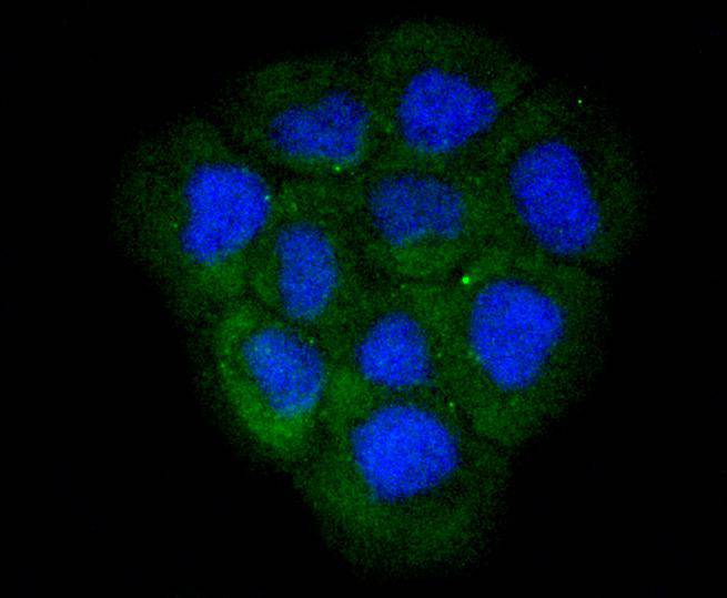 Lactate Dehydrogenase Rabbit mAb