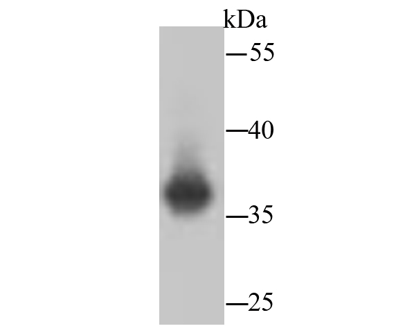 Lactate Dehydrogenase Rabbit mAb