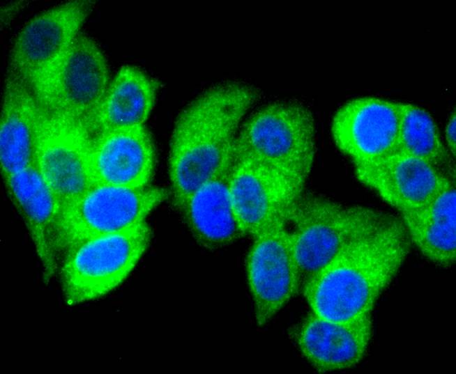 Calreticulin Rabbit mAb