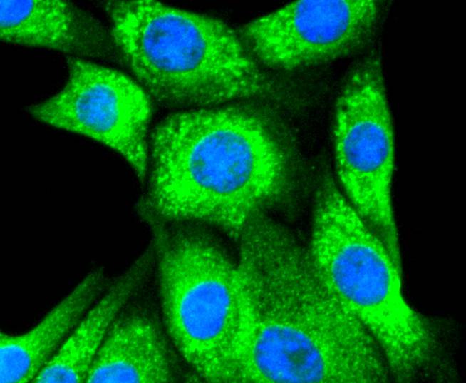 Calreticulin Rabbit mAb