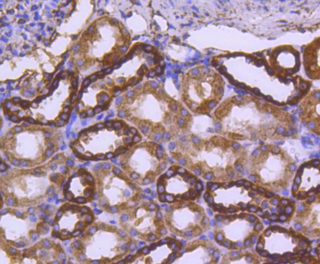 Calreticulin Rabbit mAb