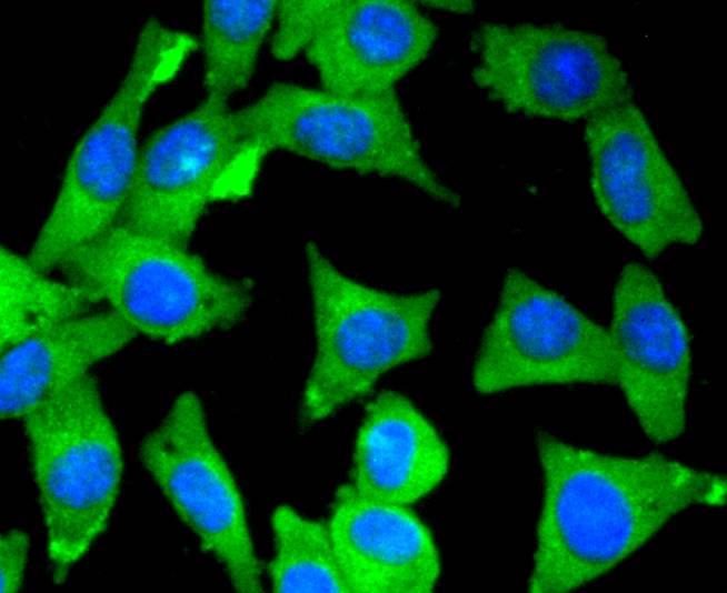 Myosin light chain kinase Rabbit mAb