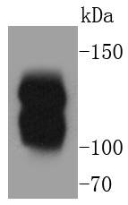 Myosin light chain kinase Rabbit mAb