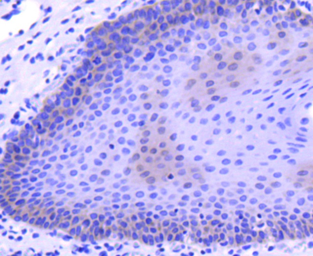 MCSF Rabbit mAb