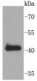 SOX18 Rabbit mAb