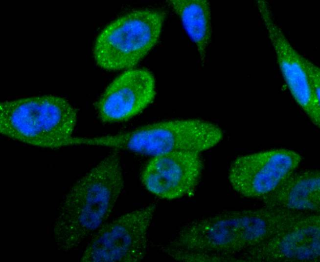 Androgen receptor Rabbit mAb