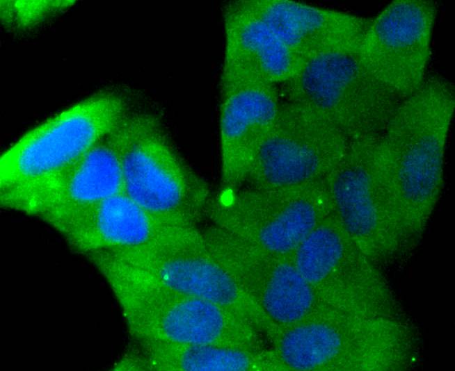 Stathmin 1 Rabbit mAb