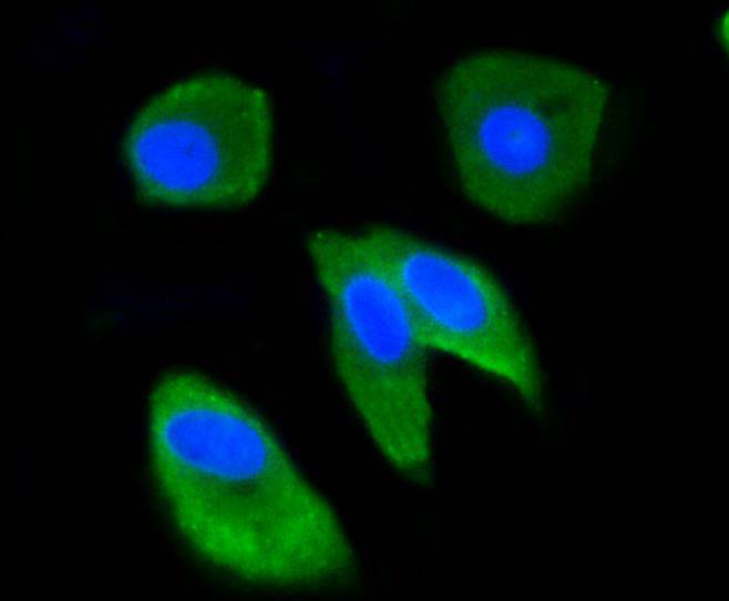 Ubiquitin Rabbit mAb