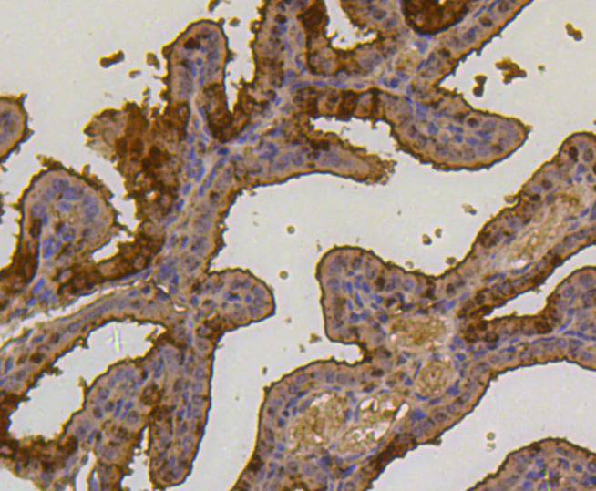 Ubiquitin Rabbit mAb