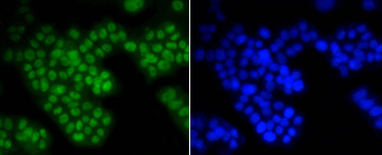 ASH2L Rabbit mAb