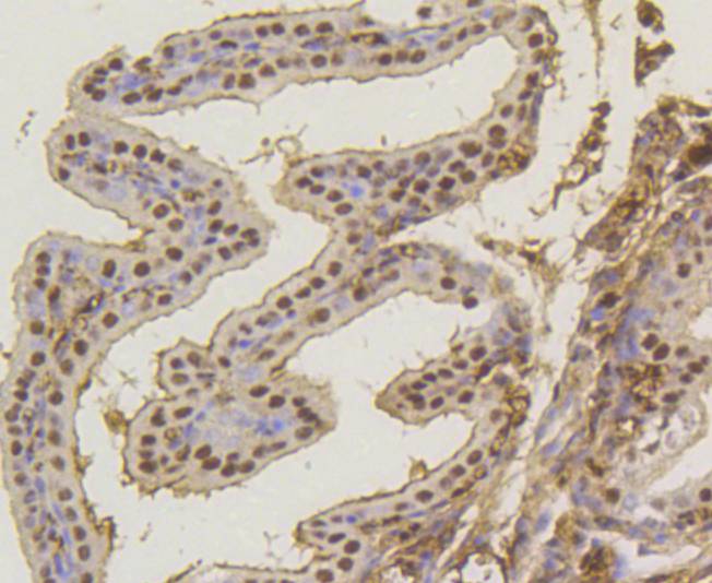 ASH2L Rabbit mAb