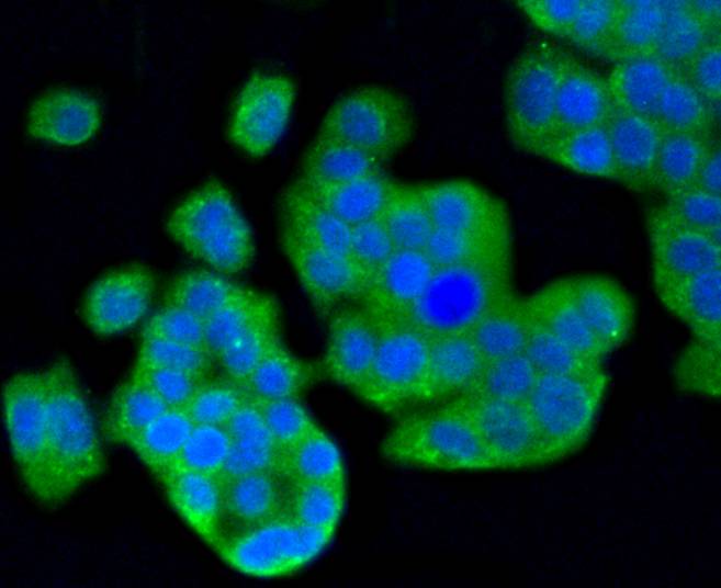 MAP1LC3A Rabbit mAb