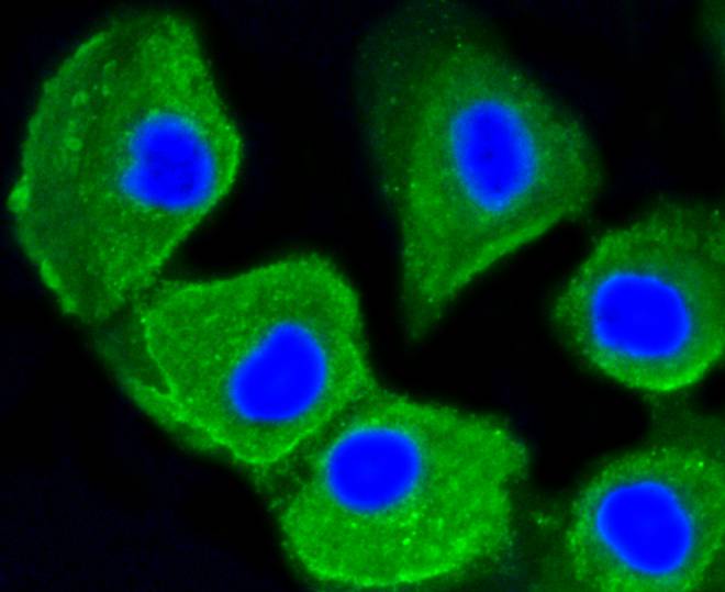 MAP1LC3A Rabbit mAb