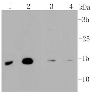 MAP1LC3A Rabbit mAb