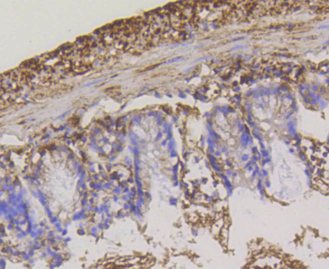 Hexokinase 1 Rabbit mAb