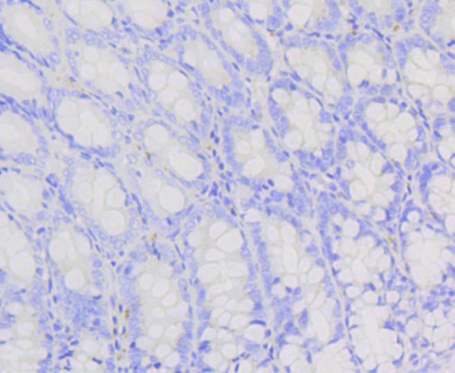 PI 3 Kinase p85 beta Rabbit mAb