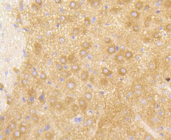 PI 3 Kinase p85 beta Rabbit mAb