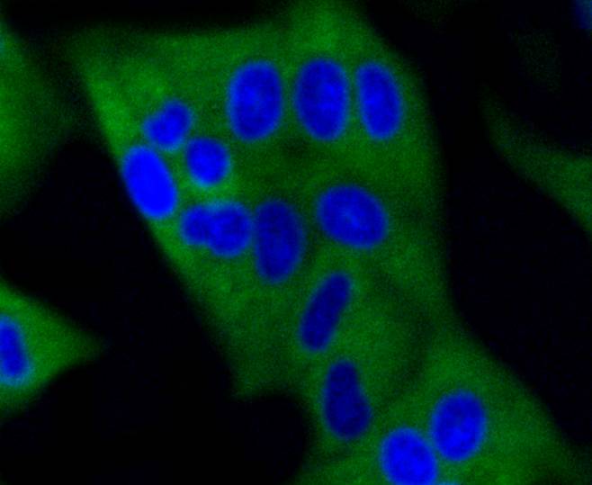 Dnmt3a Rabbit mAb