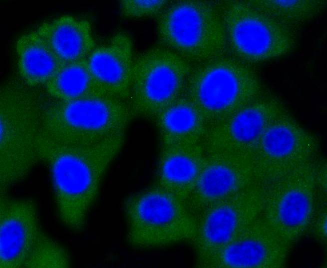 Dnmt3a Rabbit mAb