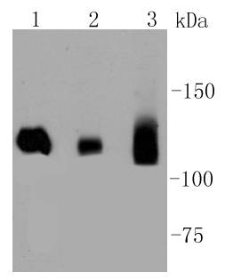 Dnmt3a Rabbit mAb