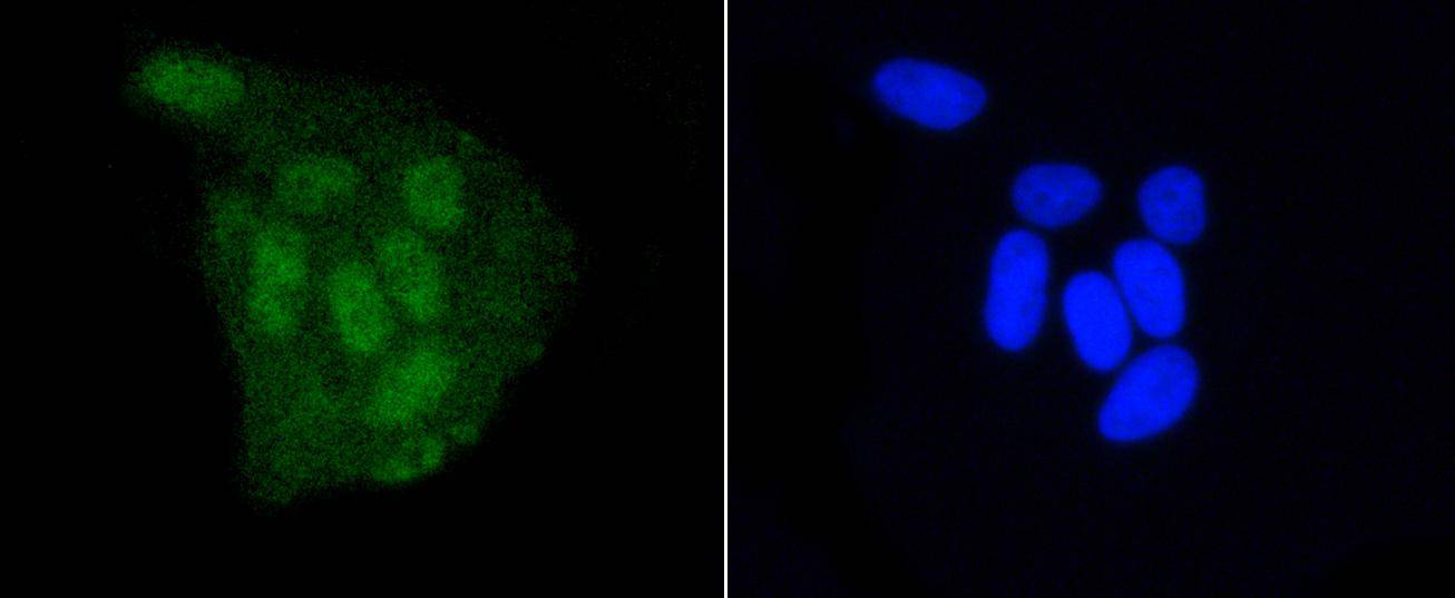 DGCR8 Rabbit mAb