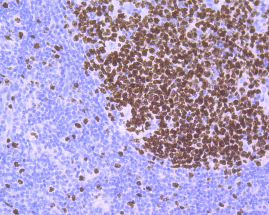 Ki67 Rabbit mAb