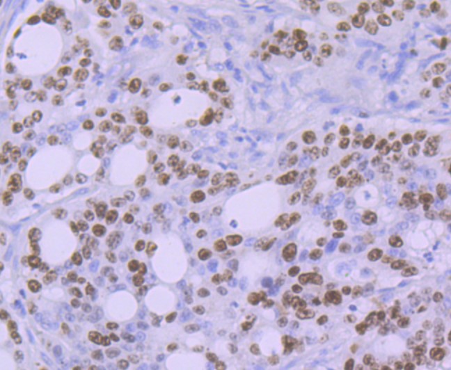 Ki67 Rabbit mAb