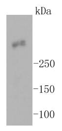 Ki67 Rabbit mAb