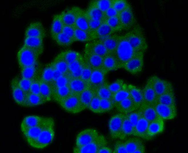 Metabotropic glutamate receptor 5 Rabbit mAb