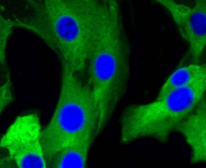 Metabotropic glutamate receptor 5 Rabbit mAb