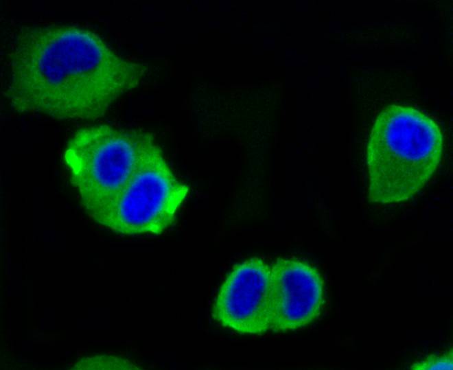 ATP citrate lyase Rabbit mAb