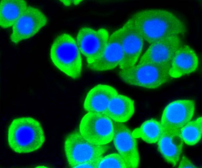 ATP citrate lyase Rabbit mAb