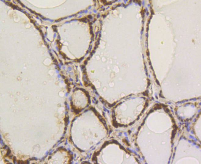 ATP citrate lyase Rabbit mAb