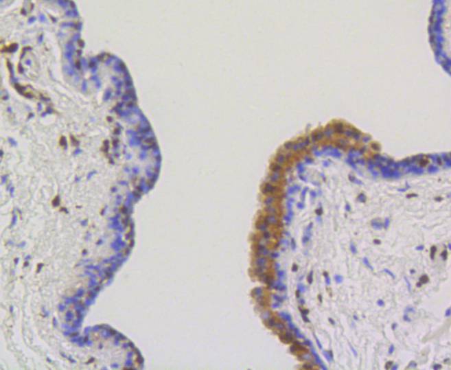 ATP citrate lyase Rabbit mAb